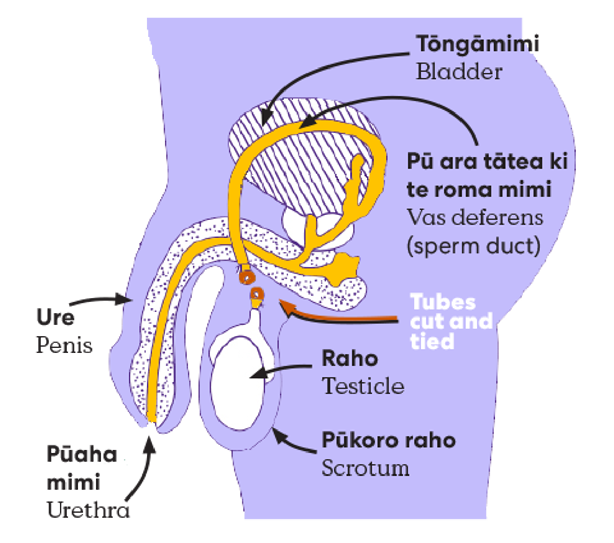 Vasectomy line drawing